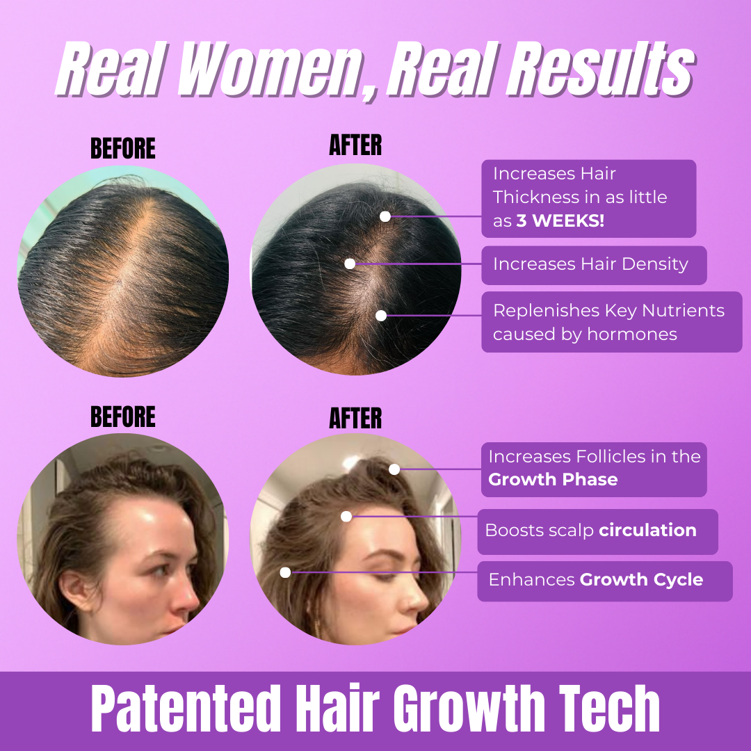 ReBloom™ – Hair Growth Accelerator Soft Chews