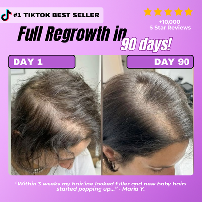 ReBloom™ – Hair Growth Accelerator Soft Chews