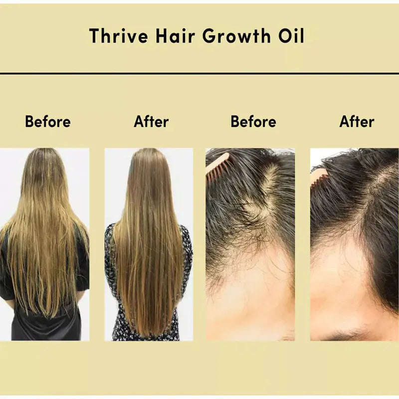Natural Hair Growth Serum - Thrive Hair Oil