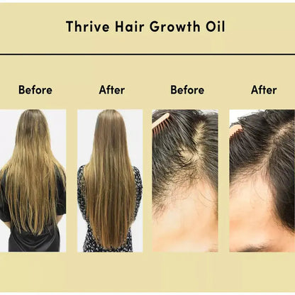 Natural Hair Growth Serum - Thrive Hair Oil